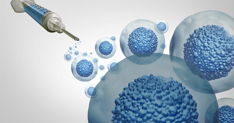 Stem Cell Therapy